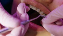 Are Cosmetic Dental Procedures Worth the Investment? Pros and Cons Explored