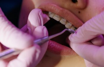 Are Cosmetic Dental Procedures Worth the Investment? Pros and Cons Explored